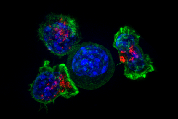 Открыт ген, способный замедлить регенерацию раковых клеток