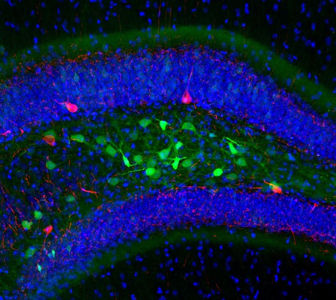  «Термогенетические технологии для управления активностью нервных сетей in vivo»: новое исследование ученых РНИМУ