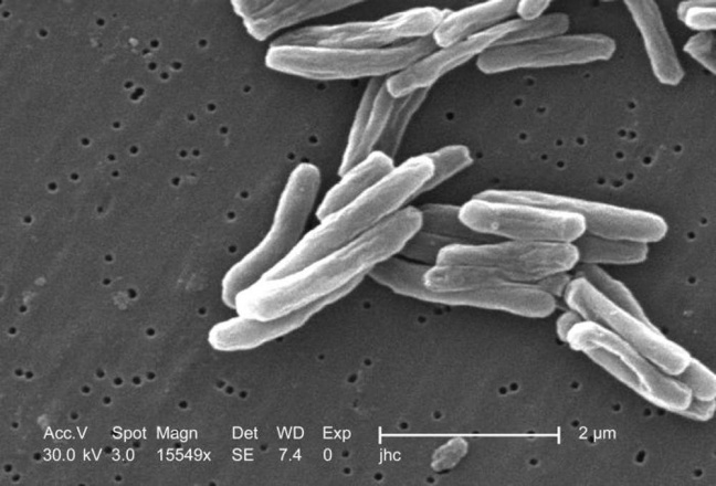 Учёные поняли, как можно предугадать развитие резистентности у бактерий