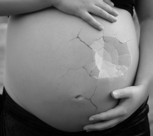 Обнаружены новые связи между невынашиванием беременности и материнскими генами
