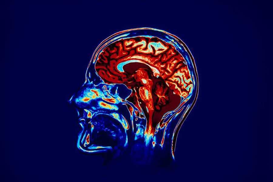 Ученые испытали мозговой имплантат