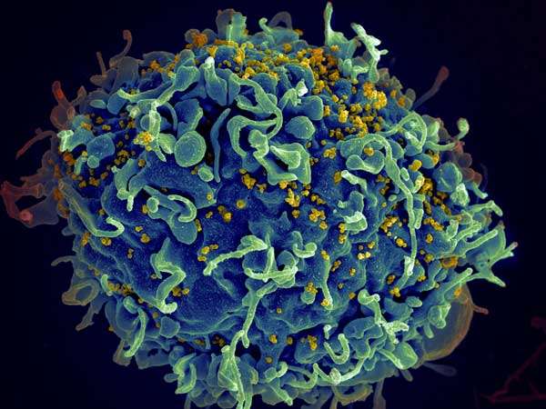 ВОЗ: Наличие ВИЧ повышает риск смерти от COVID-19