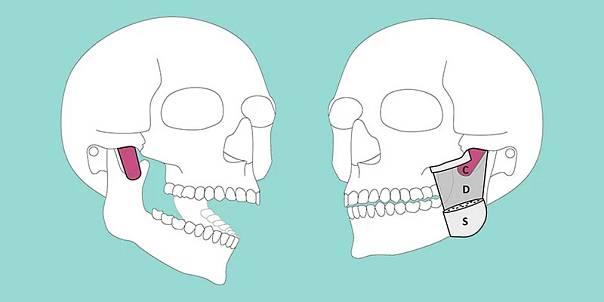 Идентифицирован новый мышечный слой в челюсти человека 