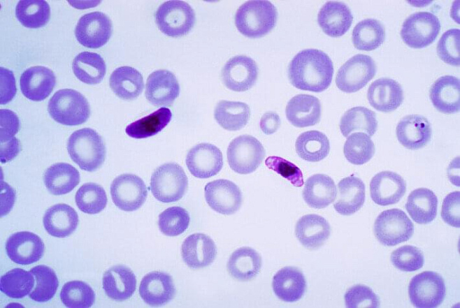 Найденная молекула дает надежду на появление лечения от смертельной формы малярии 
