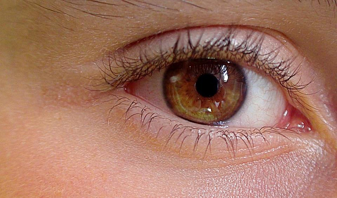 Сканирование хрусталика глаза может предсказать развитие диабета второго типа