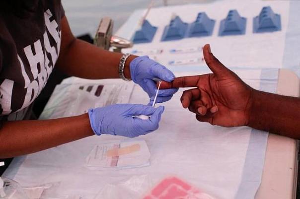 Меры по борьбе с коронавирусом могут спровоцировать рост числа новых случаев заражения ВИЧ-инфекцией