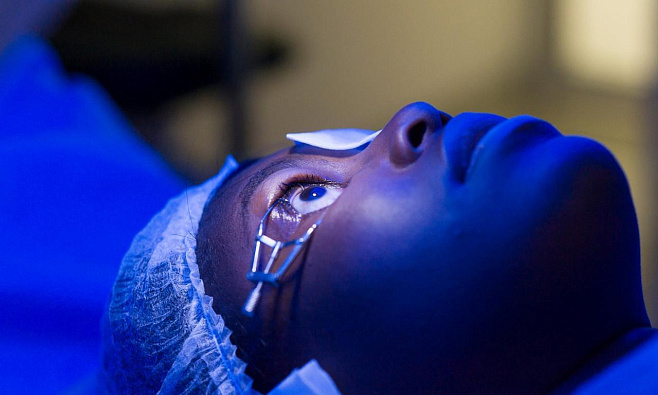 Лазер заменит глазные капли при лечении глаукомы 