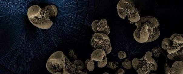 Поедающая металл бактерия, существование которой было предсказано сто лет назад, была случайно обнаружена в лаборатории