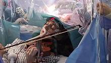 Женщина сыграла на скрипке во время операции по удалению опухоли в ее мозгу