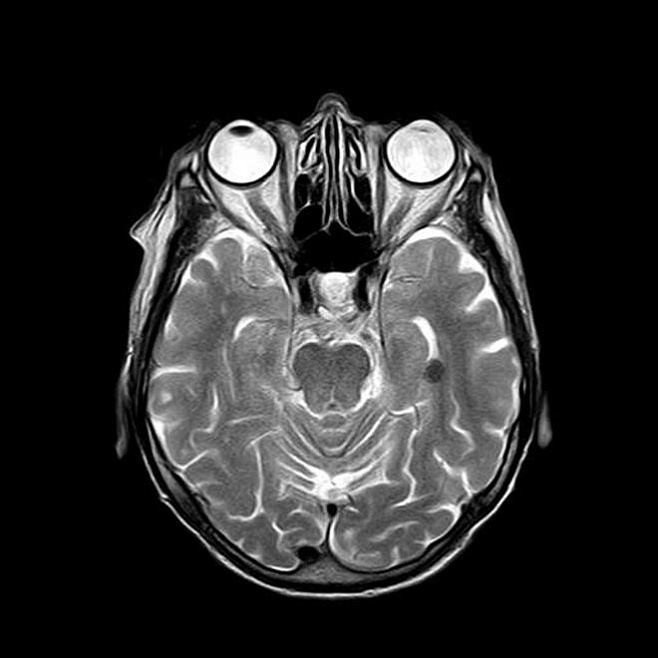 С помощью портативного сканера МРТ мозга можно будет делать прямо в машине скорой помощи