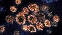 Обнаружен очередной ранее неизвестный штамм коронавируса