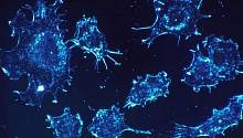Роль иммунных клеток в развитии рака: новые данные