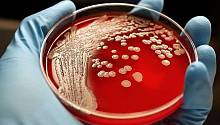 Создано вещество, способное убивать резистентные бактерии двух типов