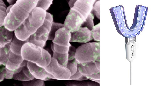 Новая жидкость для полоскания рта использует свет для уничтожения вредных бактерий