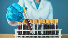 Простой анализ крови позволит улучшить диагностику рака яичников