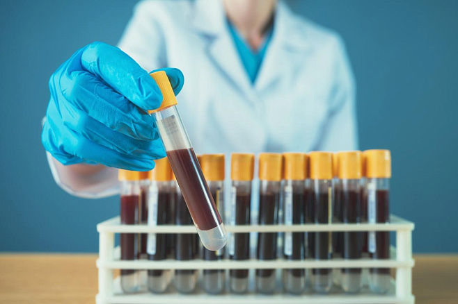 Простой анализ крови позволит улучшить диагностику рака яичников
