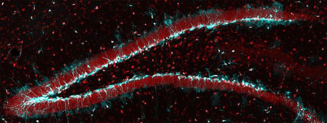 Учёные нашли способ реактивации стареющих стволовых клеток