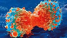 Учёные обнаружили пептид, уничтожающий раковые опухоли изнутри