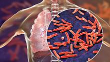 Как бактерии туберкулеза вырабатывают устойчивость к антибиотикам 