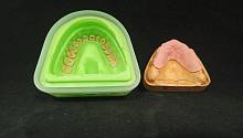 Зубные протезы на основе стекловолокна смогут служить дольше 
