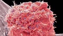 Противораковый препарат выявляет «скрывающийся» ВИЧ