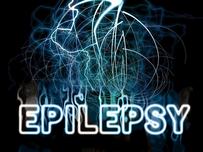 Фокальная эпилепсия часто проходит без внимания