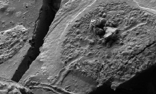 В Италии нашли отлично сохранившиеся клетки мозга возрастом в 2 тысячи лет