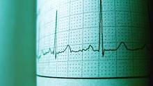 Нейросеть научили безошибочно выявлять сердечную недостаточность по кардиограмме