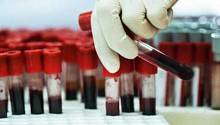 Новый тест находит супербактерии в крови пациентов всего за час