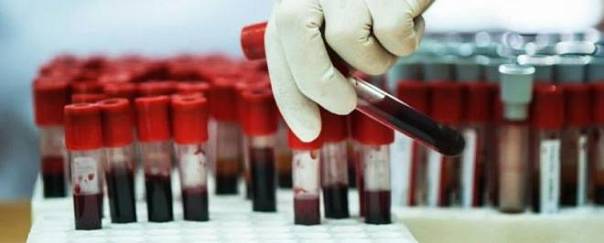 Новый тест находит супербактерии в крови пациентов всего за час