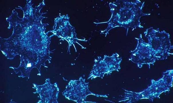 Ученые обнаружили способ приостановки развития раковых опухолей