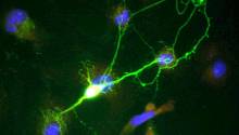 Создана новая технология биопечати нейронов
