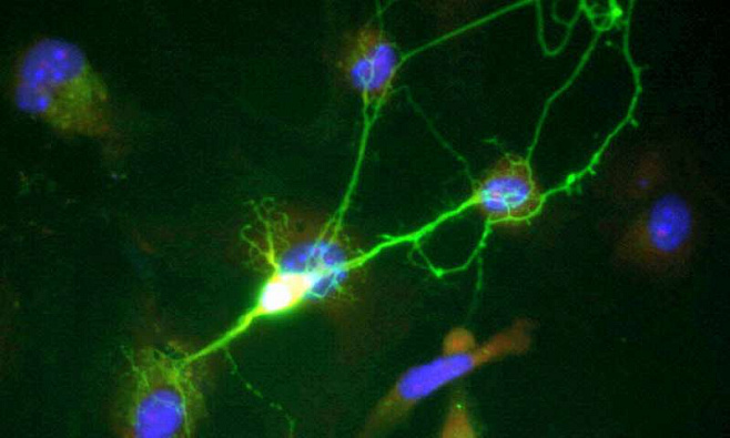 Создана новая технология биопечати нейронов
