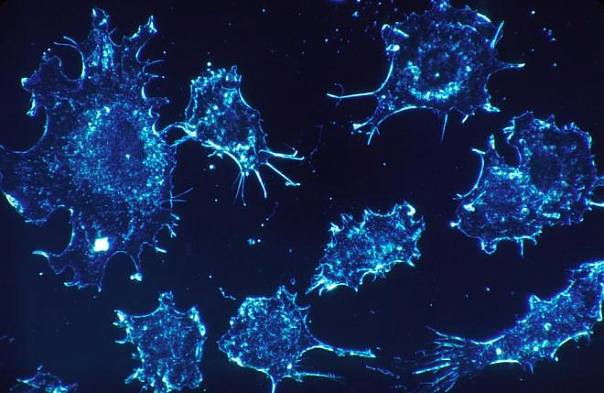 Новый препарат доказал свою эффективность в борьбе с рецидивами раковых заболеваний