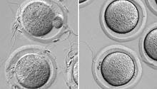 Ученым удалось открыть белок, ответственный за созревание сперматозоидов