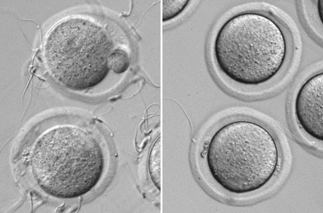 Ученым удалось открыть белок, ответственный за созревание сперматозоидов