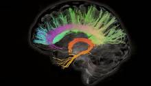 Стимуляция области мозга, связанной с сознанием, пробуждает обезьян от наркоза