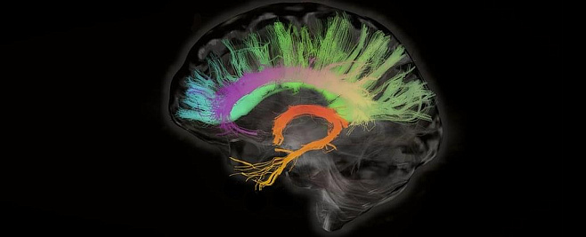 Стимуляция области мозга, связанной с сознанием, пробуждает обезьян от наркоза