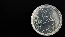 Новый тест позволит быстро отличать бактериальные инфекции от вирусных