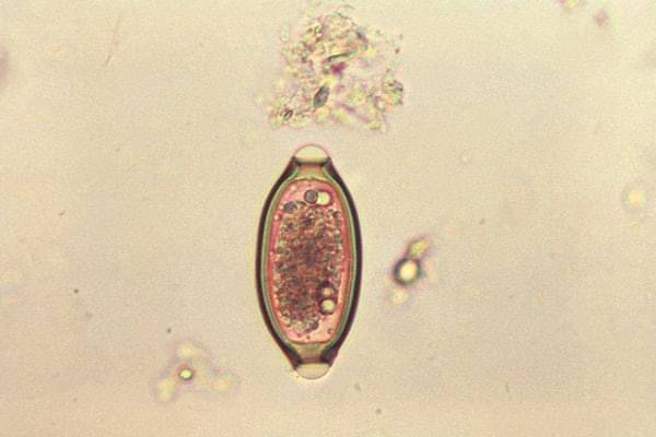 Клетчатка в рационе может стать причиной размножения желудочных паразитов