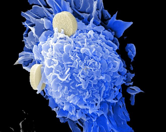 Ученые разработали наночастицы, способствующие регрессу рака