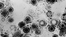 Вирус герпеса впервые появился в Африке