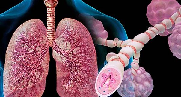 Найден эффективный препарат против тяжёлых форм астмы
