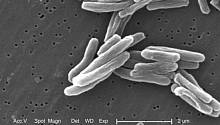 Учёные поняли, как можно предугадать развитие резистентности у бактерий