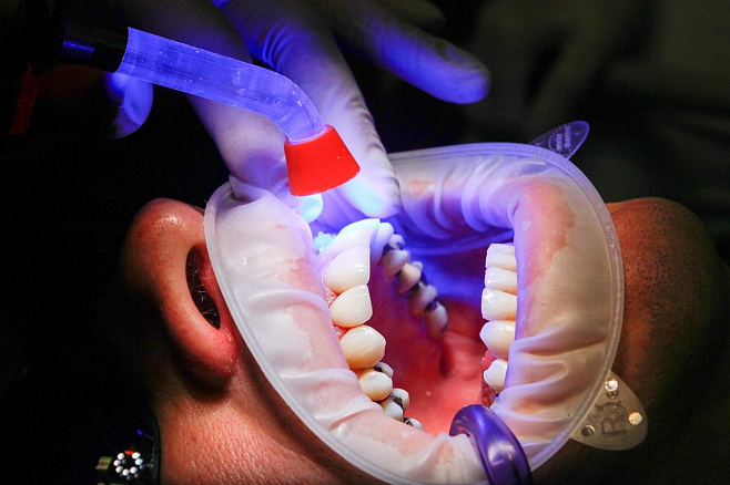 «Зубное» молоко: стволовые клетки зубов могут участвовать в регенерации молочных желез 