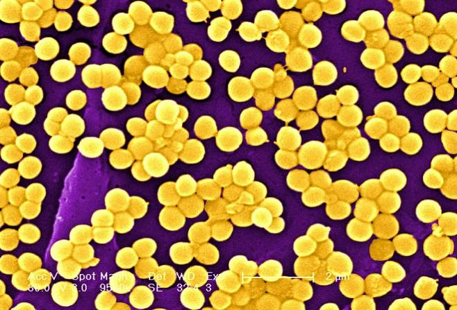 Австралийские ученые нашли способ борьбы с супербактериями
