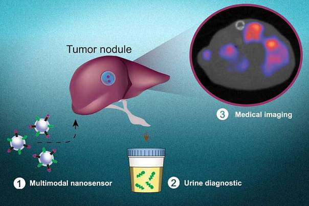 Новая технология позволит одновременно выявлять и локализовать раковые опухоли