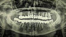 Наши зубы и кости могут состоять из остатков сверхновых 