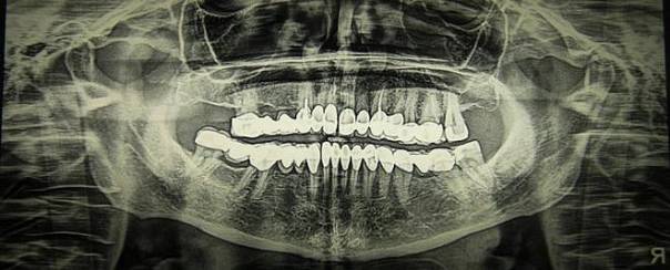 Наши зубы и кости могут состоять из остатков сверхновых 