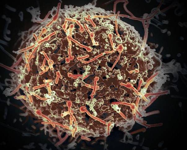 В Западной Африке зафиксирована первая за 5 лет эпидемия вируса Эбола 